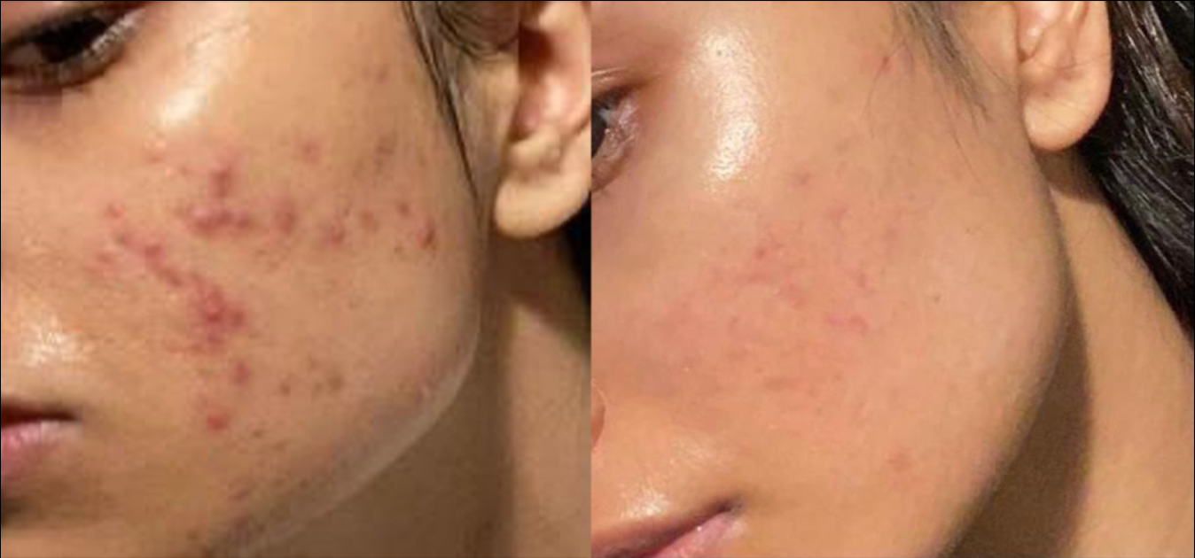 Peach Moisturizer