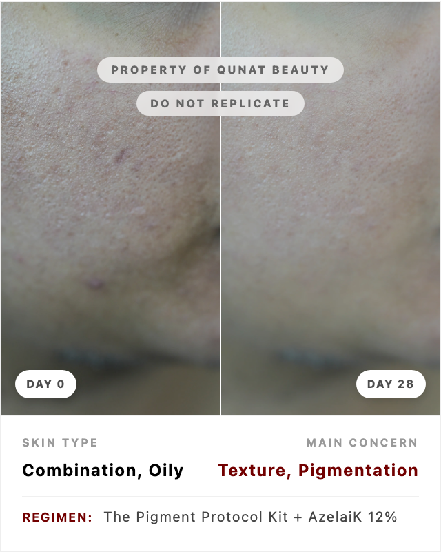 DermaSeal