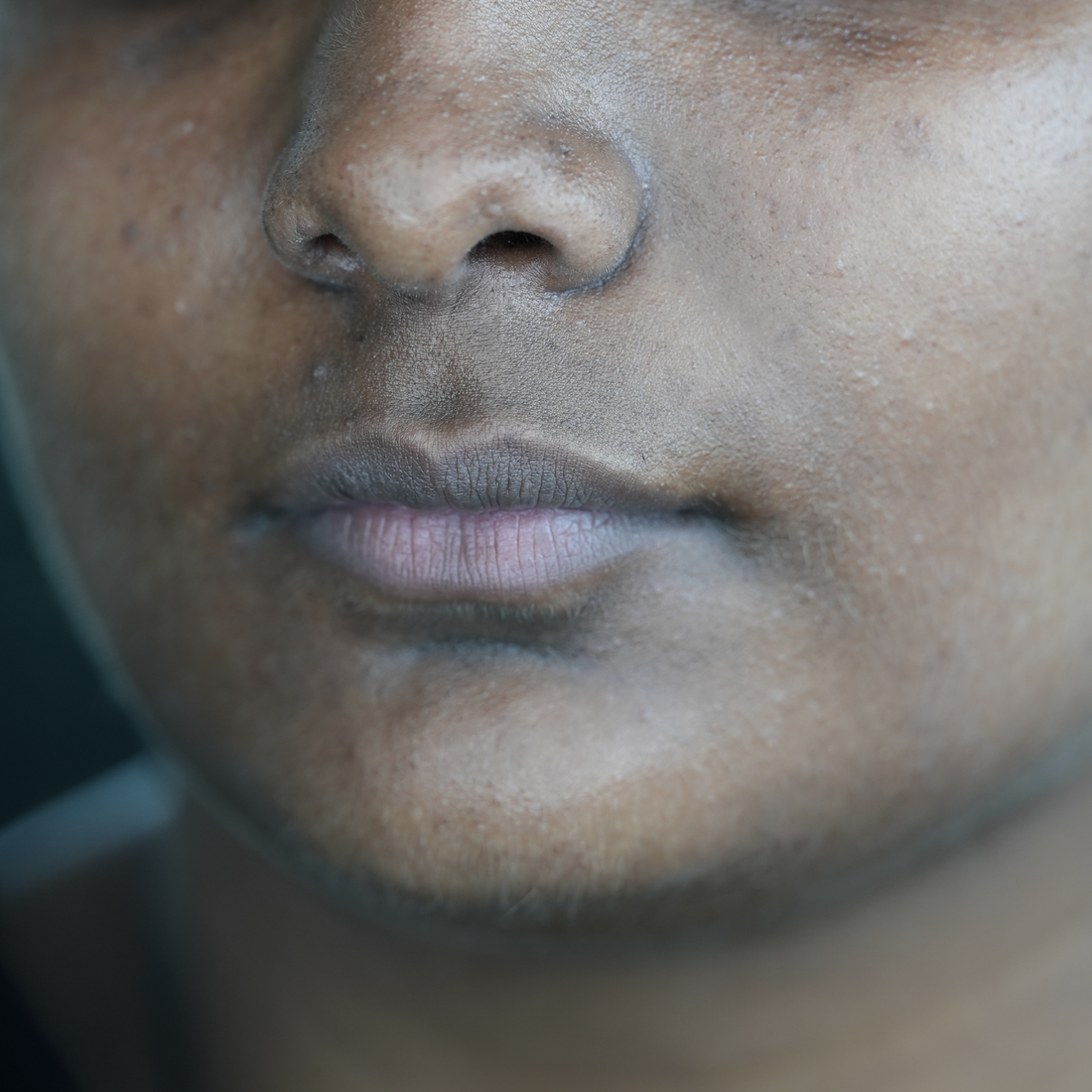 The Pigmentation Paradox