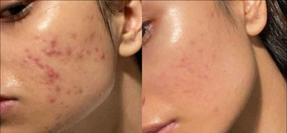 Peach Moisturizer