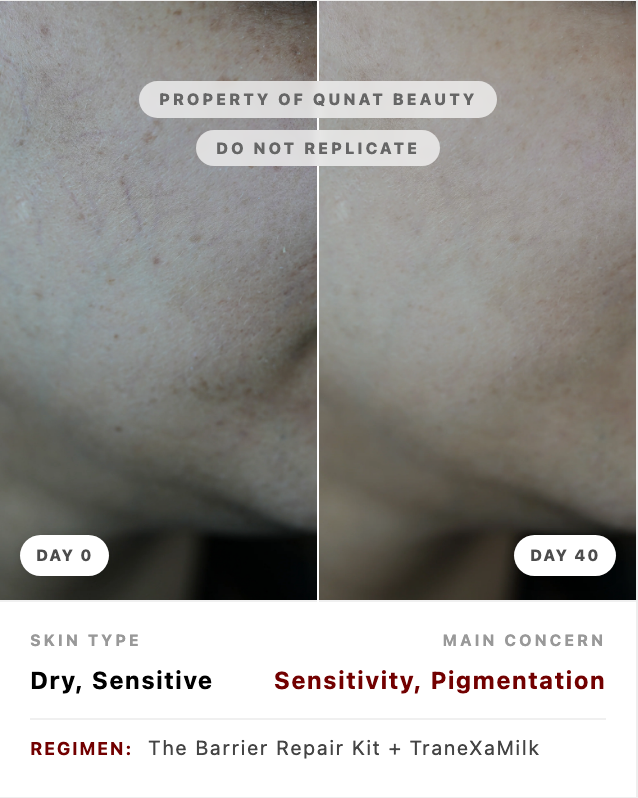 DermaSeal
