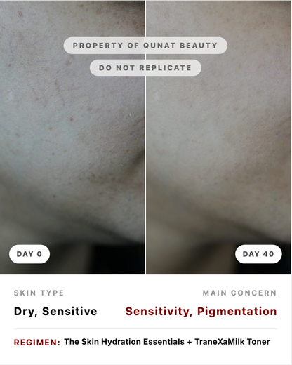 Skin Hydration Essentials